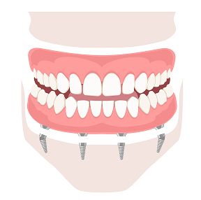 Нижней челюсти